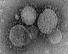 ซาอุฯตายเพิ่ม 16 ศพ จากไวรัสคล้ายซาร์สระบาด